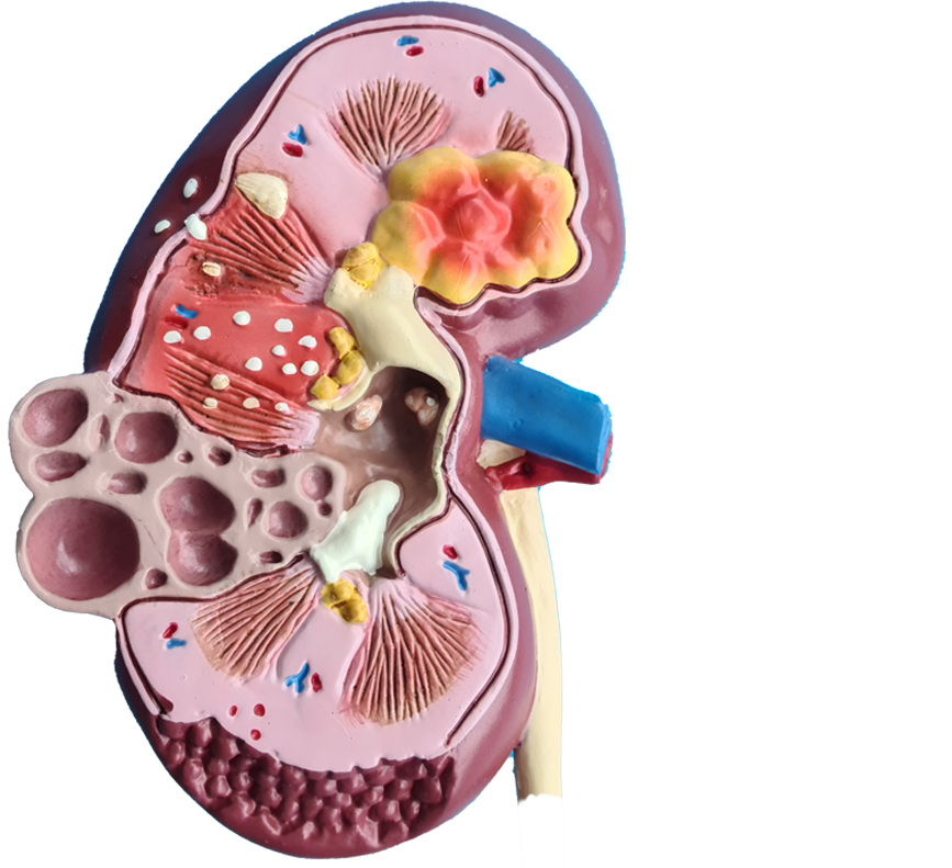 Диагностируем и лечим<br>заболевания почек