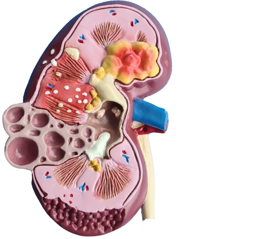 Диагностируем и лечим<br>заболевания почек